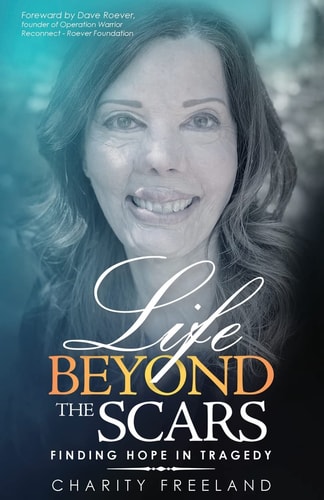 Life Beyond the Scars Finding Hope in Tragedy — Charity Freeland