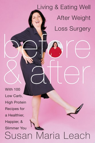 Before & After Living & Eating Well After Weight Loss Surgery — Susan Maria Leach