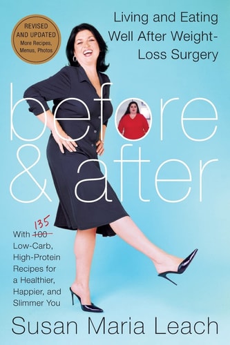 Before & After, Revised Edition Living and Eating Well After Weight-Loss Surgery — Susan Maria Leach