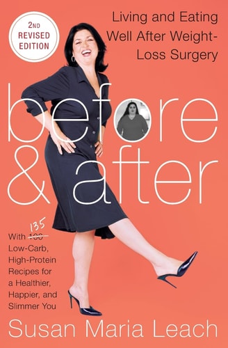 Before & After, Second Revised Edition Living and Eating Well After Weight-Loss Surgery — Susan Maria Leach
