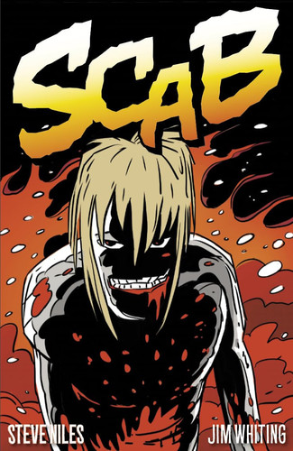 Scab A Boy, His Zombie, and the End of the Human Race — Steve Niles
