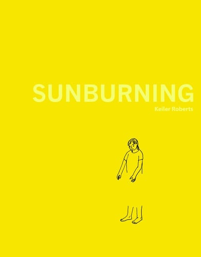 Sunburning — Keiler Roberts
